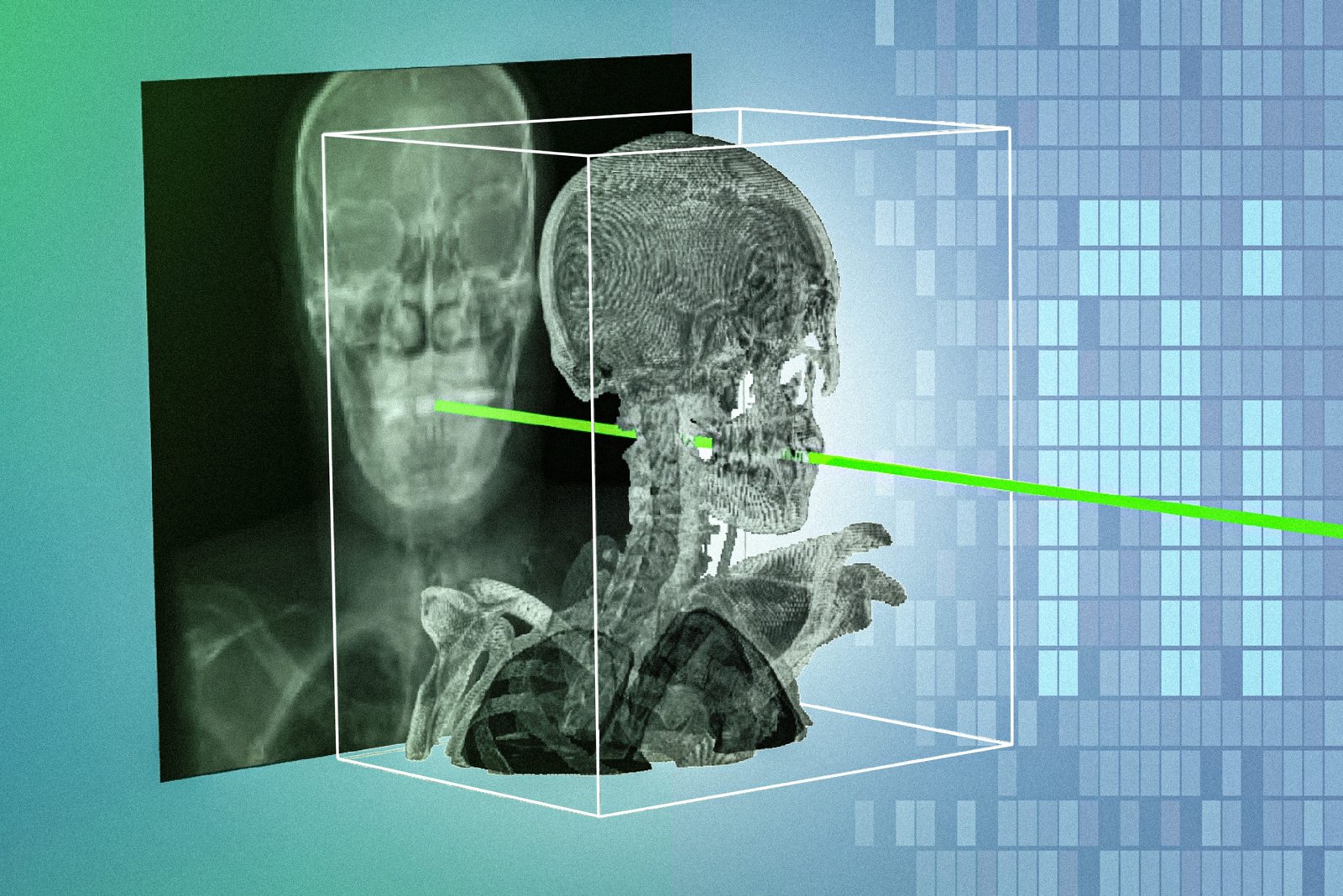 Research illustration comparing a two-dimensional skull X-ray with a three-dimensional scan