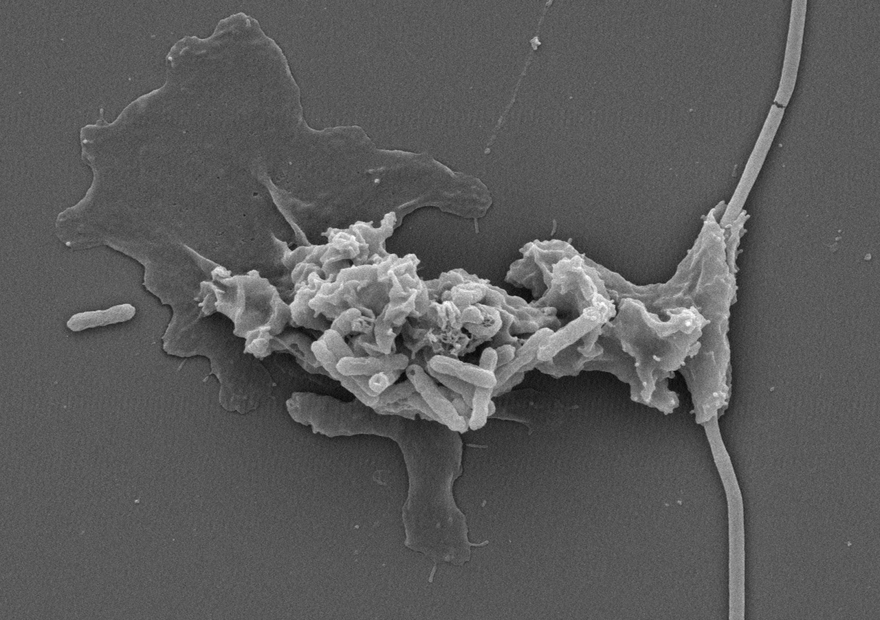 Electron micrograph of the fire amoeba Incendiamoeba cascadensis feeding on a bacterium