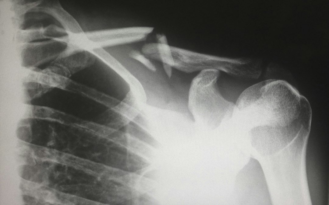 Loading Old Mouse Bones Extended Lifespan—Without Proving an Exercise Prescription