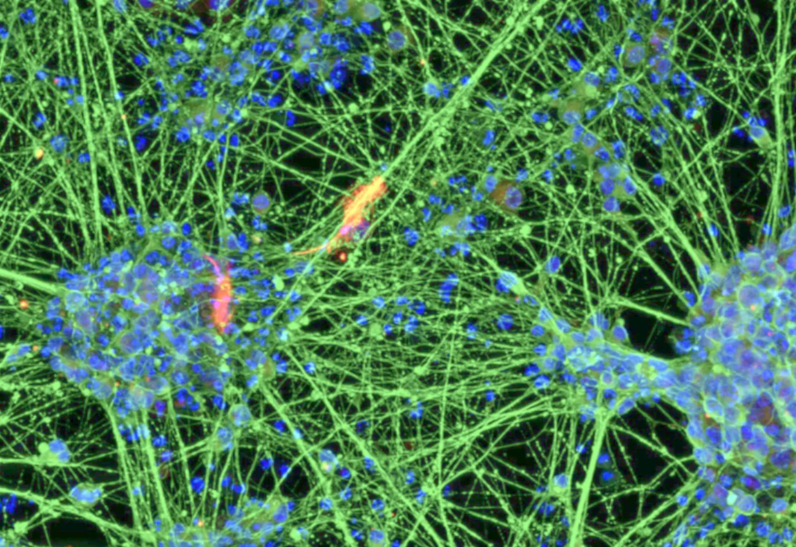 Fluorescence microscopy of neurons differentiated from blood-derived induced neural stem cells
