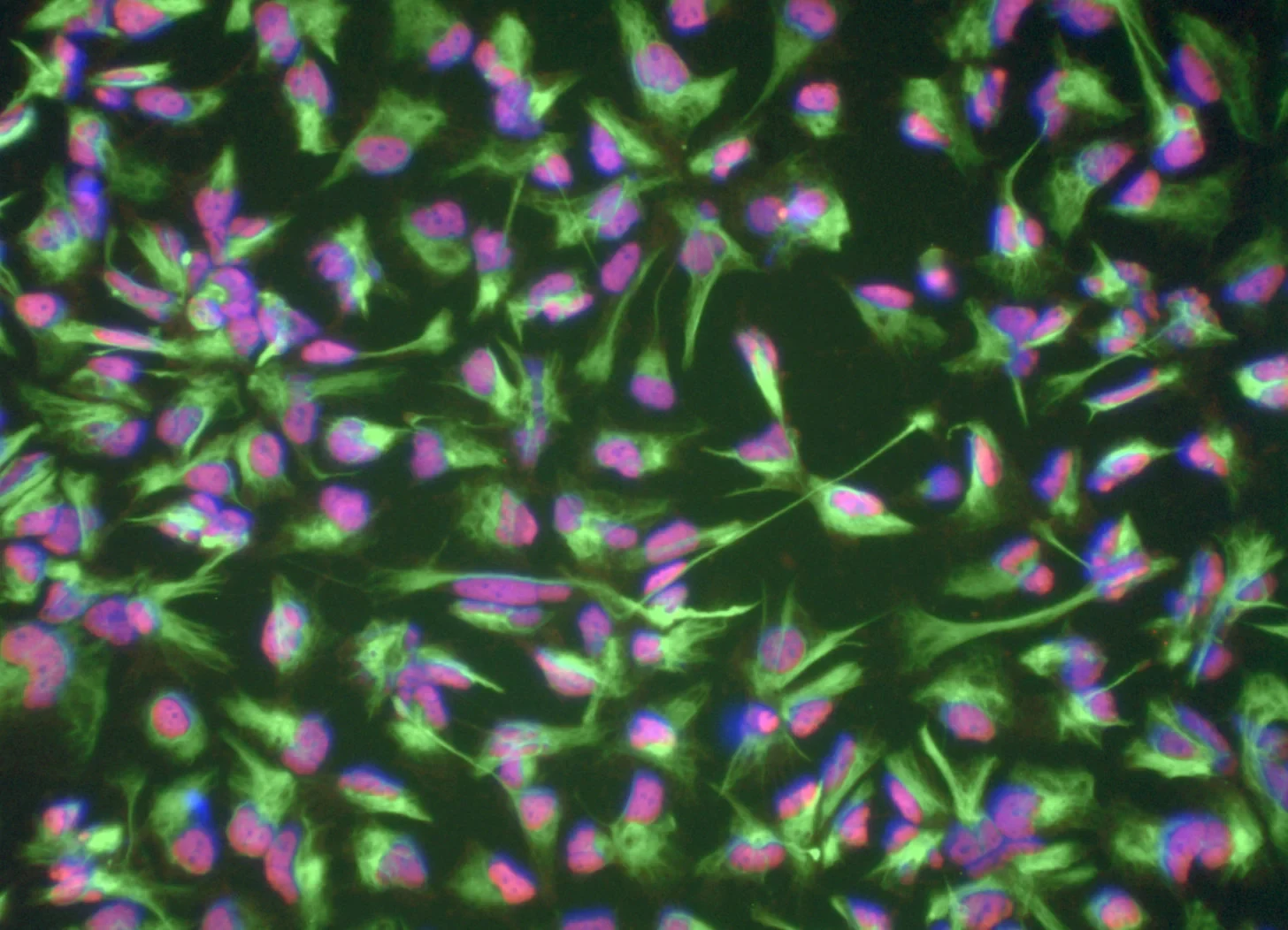 Fluorescence microscopy of induced neural stem cells derived from a 101-year-old donor’s blood cells