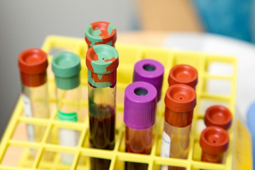 Vials of blood at the NIH Clinical Center