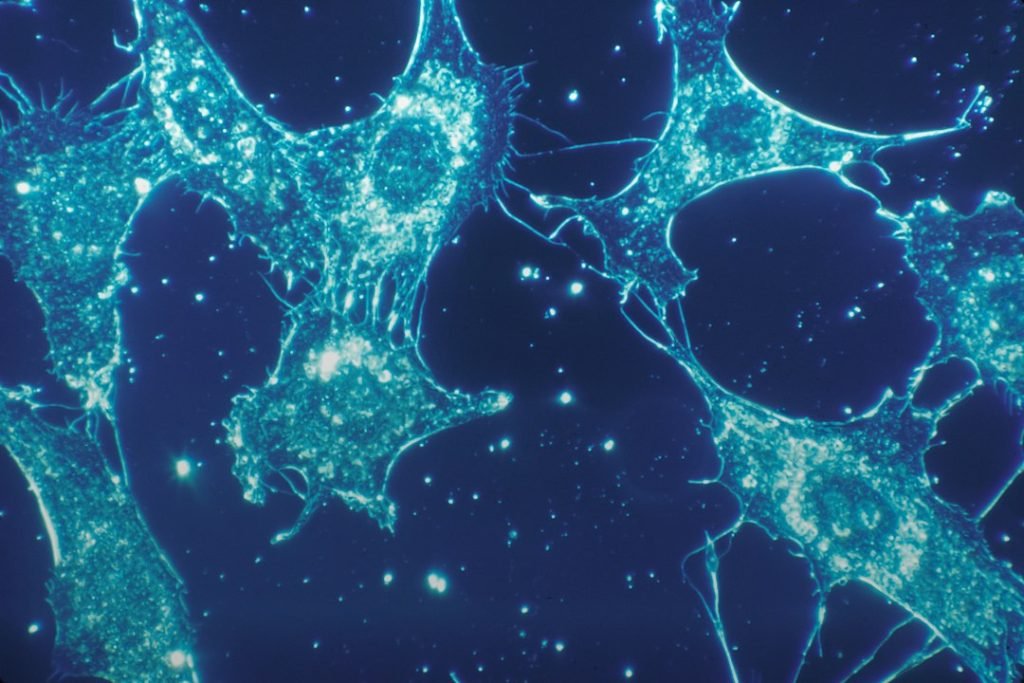Contextual image of cultured human connective-tissue cells; not recordanelle experimental data.
